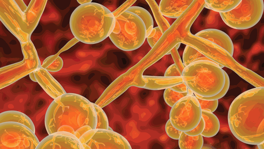 Stark vergrößerte Visualisierung von Candida auris