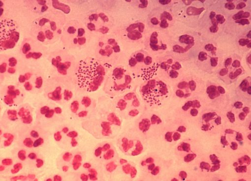 Neisseria gonorrhoeae